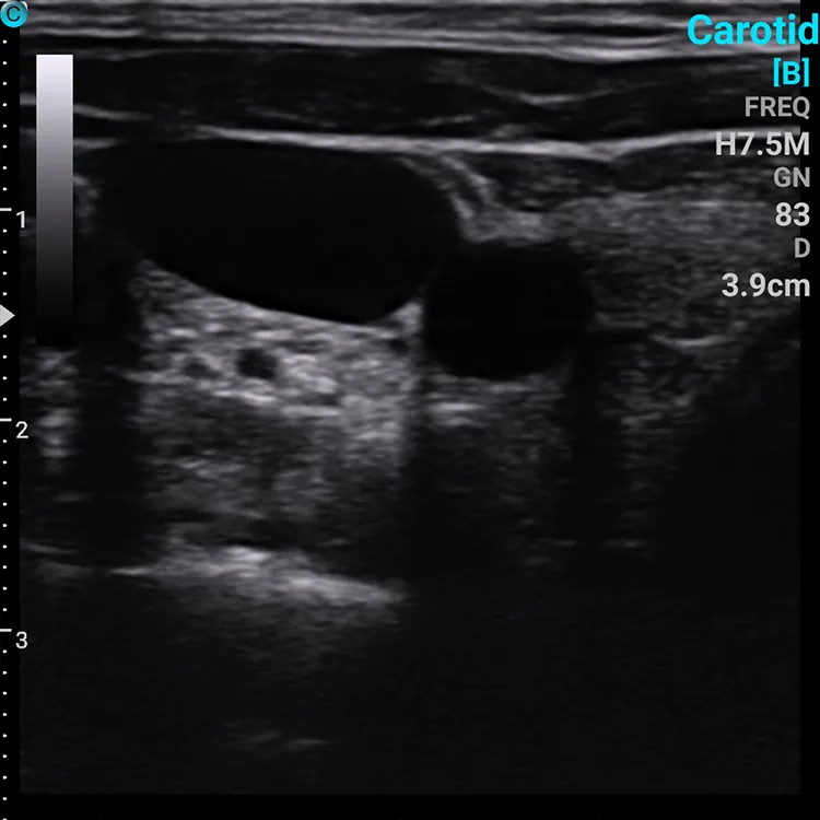 Imágenes Clínicas SonoEyes P2